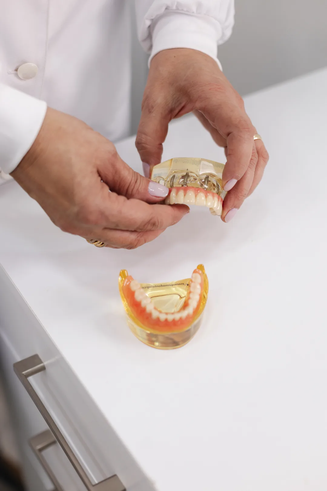 Implante dentário em Porto Alegre — Orali Odontologia, bairro Floresta, Porto Alegre